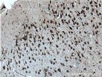 G3BP2 Antibody in Immunohistochemistry (Paraffin) (IHC (P))