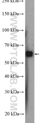 G3BP2 Antibody in Western Blot (WB)