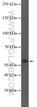 G3BP2 Antibody in Western Blot (WB)