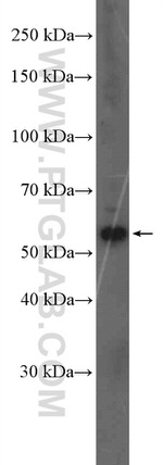 G3BP2 Antibody in Western Blot (WB)