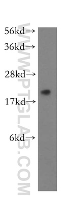 RPL11 Antibody in Western Blot (WB)