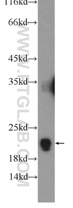 RPL11 Antibody in Western Blot (WB)