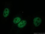 DPY30 Antibody in Immunocytochemistry (ICC/IF)