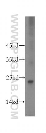 GNPNAT1 Antibody in Western Blot (WB)