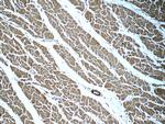 MYL12A Antibody in Immunohistochemistry (Paraffin) (IHC (P))