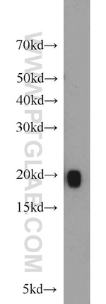 MYL12A Antibody in Western Blot (WB)