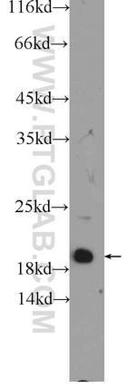 MYL12A Antibody in Western Blot (WB)