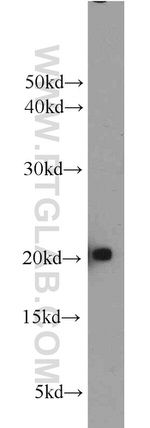 MYL12A Antibody in Western Blot (WB)