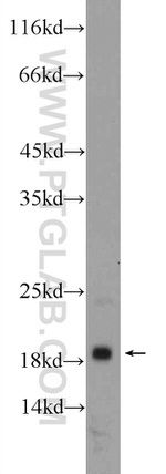 MYL12A Antibody in Western Blot (WB)