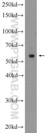 ARC/ARG3.1 Antibody in Western Blot (WB)