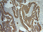 TST Antibody in Immunohistochemistry (Paraffin) (IHC (P))