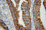 TST Antibody in Immunohistochemistry (Paraffin) (IHC (P))