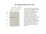 TST Antibody in Western Blot (WB)