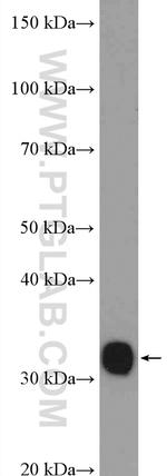 TST Antibody in Western Blot (WB)