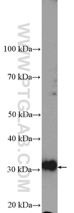 TST Antibody in Western Blot (WB)