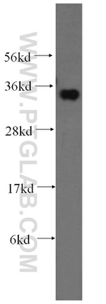 FN3KRP Antibody in Western Blot (WB)