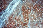 dGK Antibody in Immunohistochemistry (Paraffin) (IHC (P))