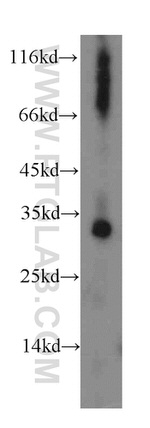 dGK Antibody in Western Blot (WB)