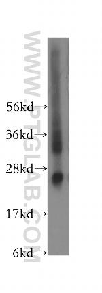 Placental lactogen Antibody in Western Blot (WB)