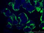 Placental lactogen Antibody in Immunohistochemistry (PFA fixed) (IHC (PFA))