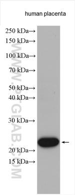 Placental lactogen Antibody in Western Blot (WB)