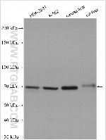 GUSB Antibody in Western Blot (WB)