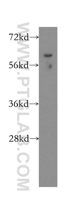 GUSB Antibody in Western Blot (WB)