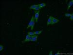 FARSB Antibody in Immunocytochemistry (ICC/IF)