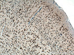 FARSB Antibody in Immunohistochemistry (Paraffin) (IHC (P))