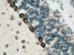 FARSB Antibody in Immunohistochemistry (Paraffin) (IHC (P))