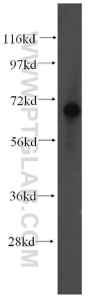 FARSB Antibody in Western Blot (WB)