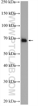 FARSB Antibody in Western Blot (WB)