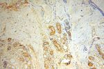 SLC35A1 Antibody in Immunohistochemistry (Paraffin) (IHC (P))