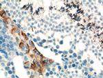 SLC35A1 Antibody in Immunohistochemistry (Paraffin) (IHC (P))