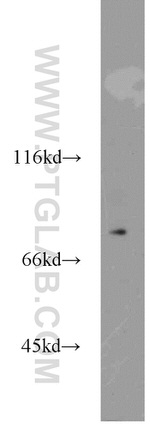 SLC3A1 Antibody in Western Blot (WB)