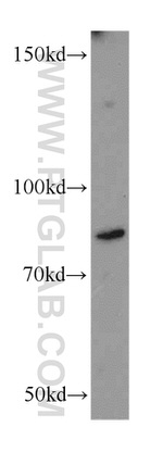 SLC3A1 Antibody in Western Blot (WB)