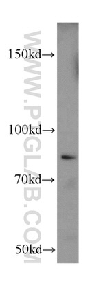 SLC3A1 Antibody in Western Blot (WB)