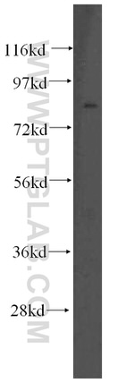 SLC3A1 Antibody in Western Blot (WB)