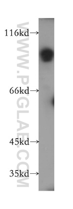 SLC3A1 Antibody in Western Blot (WB)