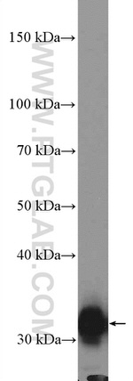 SULT2A1 Antibody in Western Blot (WB)