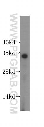 SULT2A1 Antibody in Western Blot (WB)