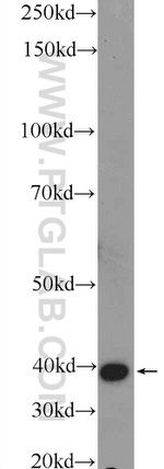 BHMT2 Antibody in Western Blot (WB)