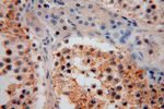 PSG11 Antibody in Immunohistochemistry (Paraffin) (IHC (P))