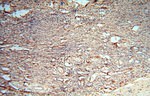 cyclin I Antibody in Immunohistochemistry (Paraffin) (IHC (P))