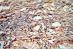 cyclin I Antibody in Immunohistochemistry (Paraffin) (IHC (P))