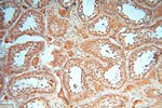 cyclin I Antibody in Immunohistochemistry (Paraffin) (IHC (P))