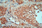 cyclin I Antibody in Immunohistochemistry (Paraffin) (IHC (P))