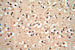 cyclin I Antibody in Immunohistochemistry (Paraffin) (IHC (P))