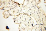 MRPS21 Antibody in Immunohistochemistry (Paraffin) (IHC (P))