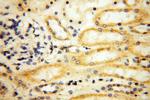 MRPS21 Antibody in Immunohistochemistry (Paraffin) (IHC (P))